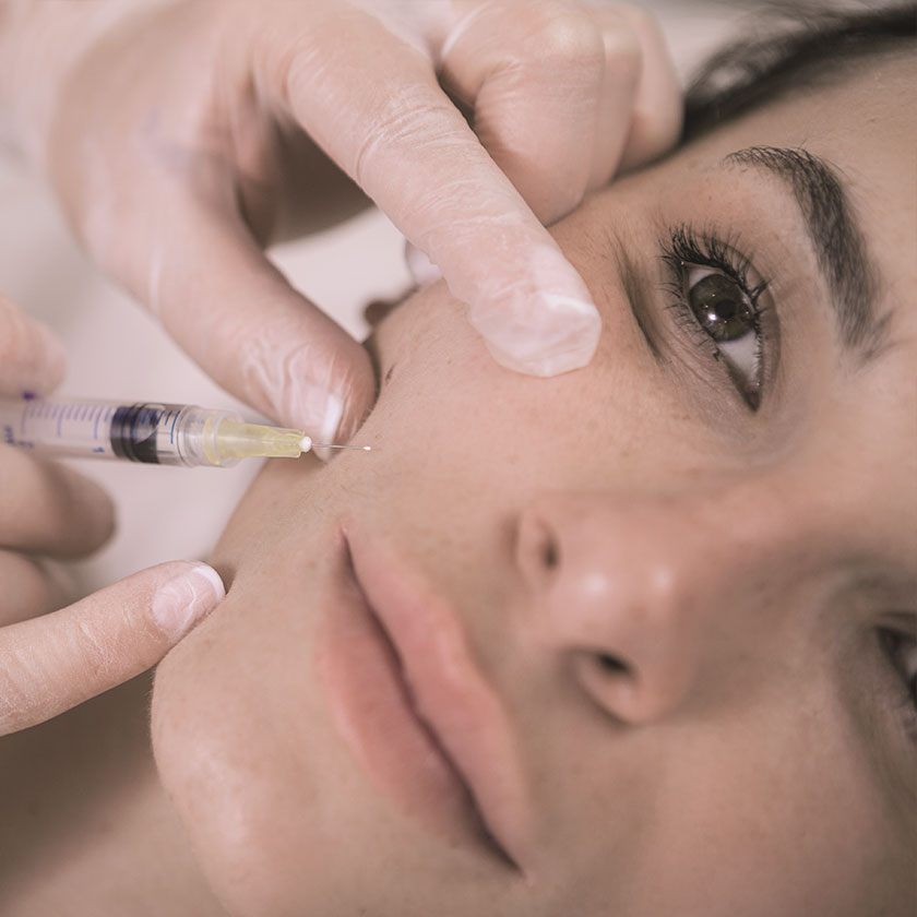 Biostimulator Hautbehandlung Faltenbehandlung, Anti-Aging - AVORYA