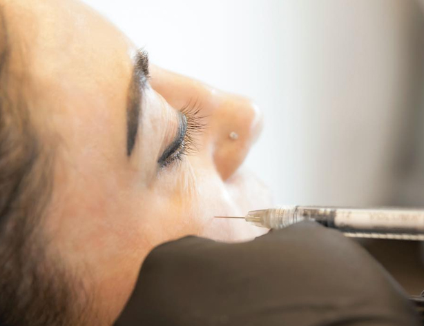 Biostimulator vs. Botulinumtoxin – Zwei Wege zur Hautverjüngung im Vergleich